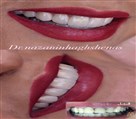دکتر نازنین حق شناس (دندانپزشک زیبایی) - تصویر 93307