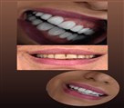 دکتر نازنین حق شناس (دندانپزشک زیبایی) - تصویر 93310