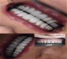 دکتر نازنین حق شناس (دندانپزشک زیبایی) - تصویر 93312