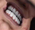 دکتر نازنین حق شناس (دندانپزشک زیبایی) - تصویر 93313