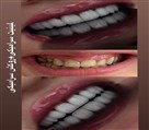 دکتر نازنین حق شناس (دندانپزشک زیبایی) - تصویر 93314