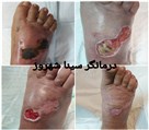 کلینیک درمان زخم و دیابت مهرشهر - تصویر 97069