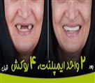 کلینیک دندانپزشکی نیکان اهواز - تصویر 99024
