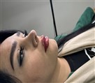 کلینیک زیبایی دکتر حمیدرضا خسروی - تصویر 100439