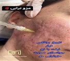 کلینیک زیبایی دکتر نگین شریفی - تصویر 102255