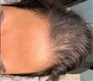 لاین آرایش دائم و میکرواسکالپ کلینیک اوکتا - تصویر 104930