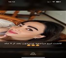 کیلنیک زیبایی مهرزاد - نمونه کار کاشت ابرو بعد از ۸ ماه💕