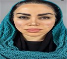 کیلنیک زیبایی مهرزاد - بعد از انجام لیفت نخ 😍🤌🏻