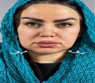 کیلنیک زیبایی مهرزاد - قبل از انجام لیفت نخ ✨😅
