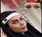 کیلنیک زیبایی مهرزاد - نمونه کار کاشت ابرو 🤌🏻😍