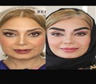 کیلنیک زیبایی مهرزاد - قبل و بعد کاشت ابرو بازیگر عزیزمون 🌹