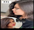 کیلنیک زیبایی مهرزاد - جراحی بینی بعد از ۲ ماه😍🤌🏻