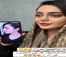 کیلنیک زیبایی مهرزاد - نمونه کار جراحی بینی قبل و بعد بینی استخونی😍