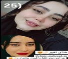 کیلنیک زیبایی مهرزاد - جراحی بینی رفع افتادگی و نواقص بینی