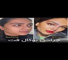 کیلنیک زیبایی مهرزاد - تصویر 137749