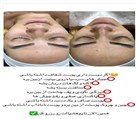 سالن زیبایی پناه بیوتی - تصویر 117780
