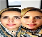 کلینیک زیبایی دکتر رضا مهدوی - هایفو VIP سلبریتی ها
