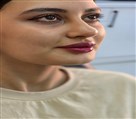 کلینیک زیبایی دکتر رضا مهدوی - فیلر لب روسی (به محض تزریق)