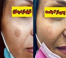کلینیک زیبایی اُکتا OKTA - تصویر 121260