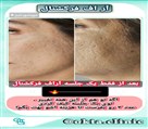 کلینیک زیبایی اُکتا OKTA - تصویر 121264