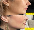 کلینیک زیبایی اُکتا OKTA - تصویر 121275