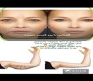 کلینیک پوست زیبایی ونوس (دکتر سیامک یاسمی) - پرولیفت 