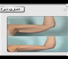 کلینیک پوست زیبایی ونوس (دکتر سیامک یاسمی) - لیفت بازو با پرولیفت قوی