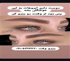 مرکز تخصصی فیبروز ابرو فرزانه کریمی - تصویر 143750