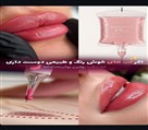 مرکز تخصصی فیبروز ابرو فرزانه کریمی - تصویر 143757