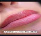 مرکز تخصصی فیبروز ابرو فرزانه کریمی - تینت و شیدینگ لب