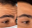 کلینیک زیبایی، لیزر و لاغری اسکین فیت - تصویر 119301