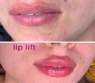 کلینیک زیبایی، لیزر و لاغری اسکین فیت - تصویر 119303