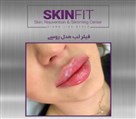 کلینیک زیبایی، لیزر و لاغری اسکین فیت - تصویر 119304