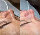 کلینیک زیبایی، لیزر و لاغری اسکین فیت - تصویر 119308