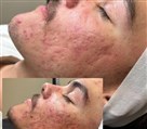 کلینیک زیبایی، لیزر و لاغری اسکین فیت - تصویر 119310