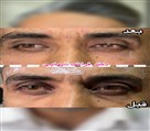 کلینیک پوست، مو و لیزر لوه - تصویر 120133