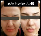 کلینیک پوست، مو و لیزر لوه - تصویر 120137