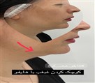 کلینیک پوست، مو و لیزر لوه - تصویر 120140