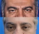 کلینیک پوست، مو و لیزر لوه - تصویر 137130