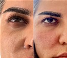 کلینیک لیزر و زیبایی آنابل - تصویر 120651
