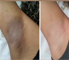 کلینیک لیزر و زیبایی آنابل - تصویر 129065