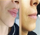 مطب دکتر فاطمه خزایی - تصویر 120255