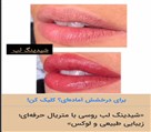 مرکز میکروپیگمنتیشن لیدا دهخدا - تصویر 138778