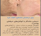 مرکز میکروپیگمنتیشن لیدا دهخدا - تصویر 138779