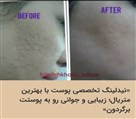 مرکز میکروپیگمنتیشن لیدا دهخدا - تصویر 138780
