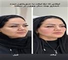 کیلینیک زیبایی بایو آس - تصویر 120743