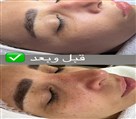 آموزش و خدمات فشیال سوده - تصویر 120843