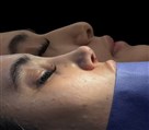 کلینیک جراحی زیبایی الماس (بدن و صورت) - نمونه جراحی‌های اخیر