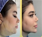 کلینیک جراحی زیبایی الماس (بدن و صورت) - نمونه جراحی‌های اخیر