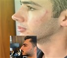 کلینیک جراحی زیبایی الماس (بدن و صورت) - نمونه جراحی‌های اخیر